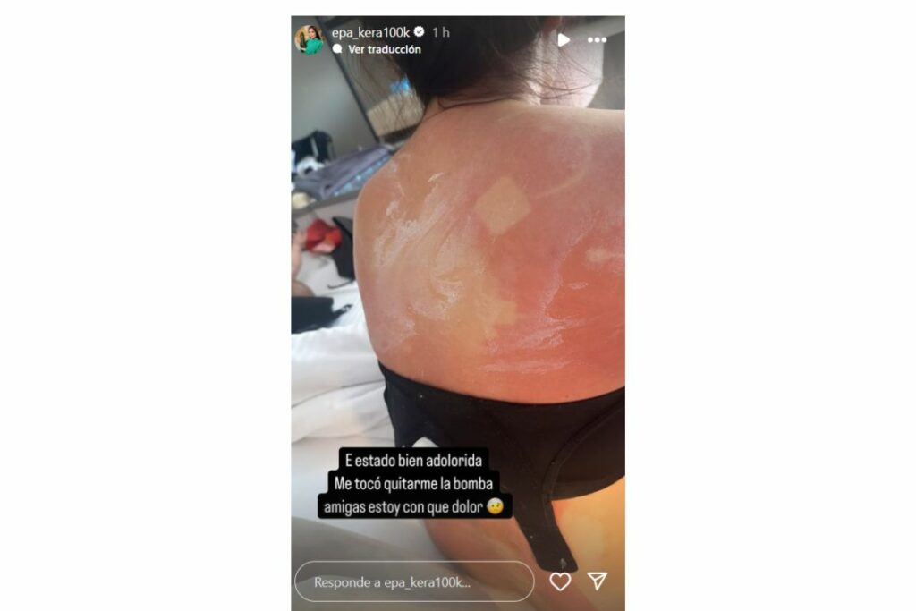 'Epa Colombia' mostró su estado de salud, luego de someterse a varias operaciones / captura de pantalla instagram epa_kera100k
