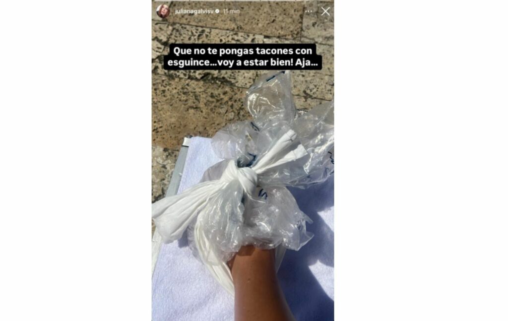 Juliana Galvis mostró el accidente que tuvo en su pie en este inicio de 2025. Foto: Instagram.