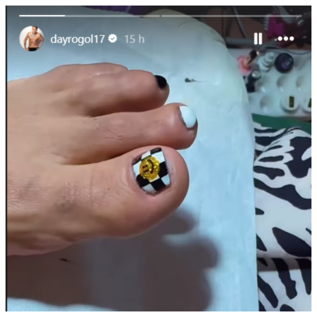 Dayro Moreno mostró las uñas de sus pies / Instagram @dayrogol17