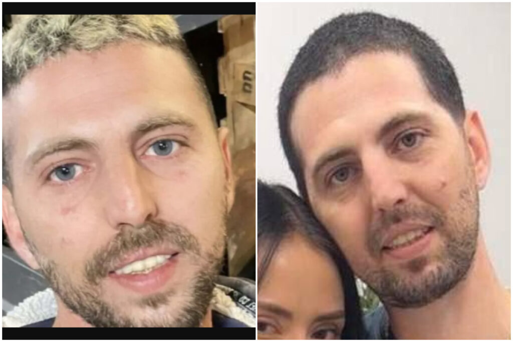 Fotos antes y después de Elkana Bohbot.