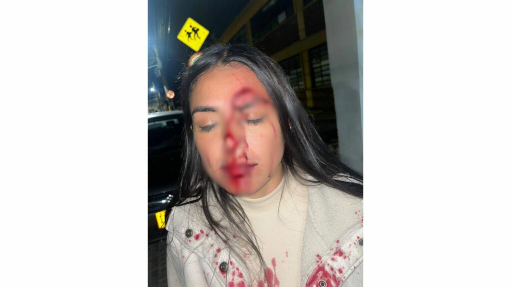 Laura Cifuentes (mujer agredida) / Facebook: Cifuentes Laura