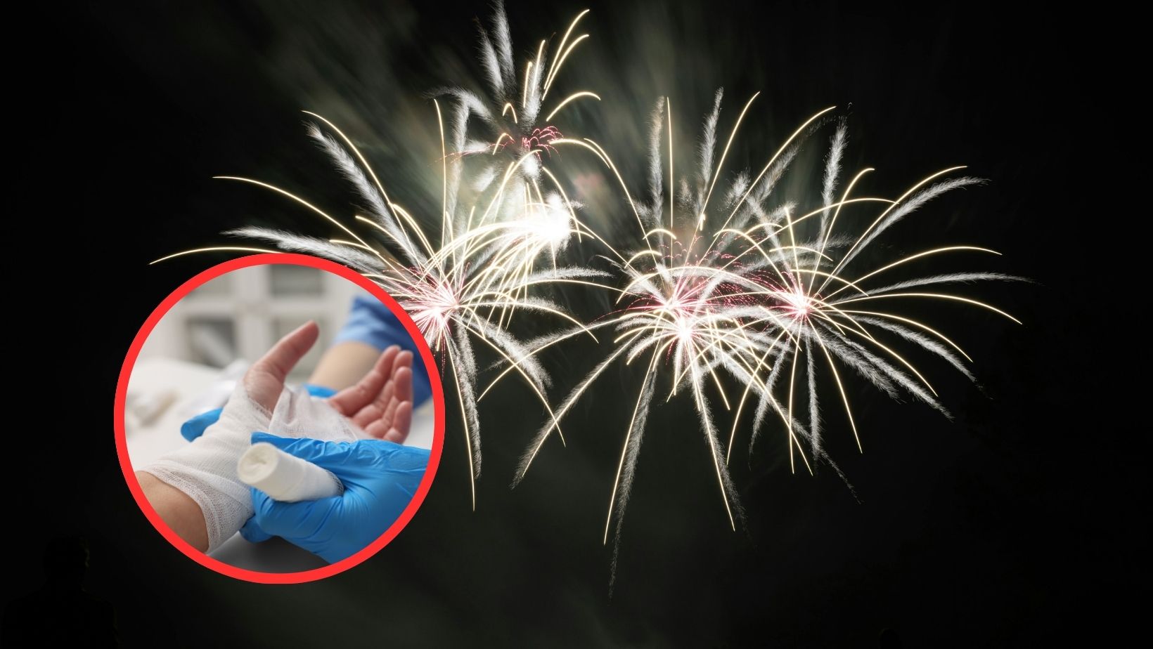 Van más de 300 quemados con pólvora luego del fin de semana de Velitas