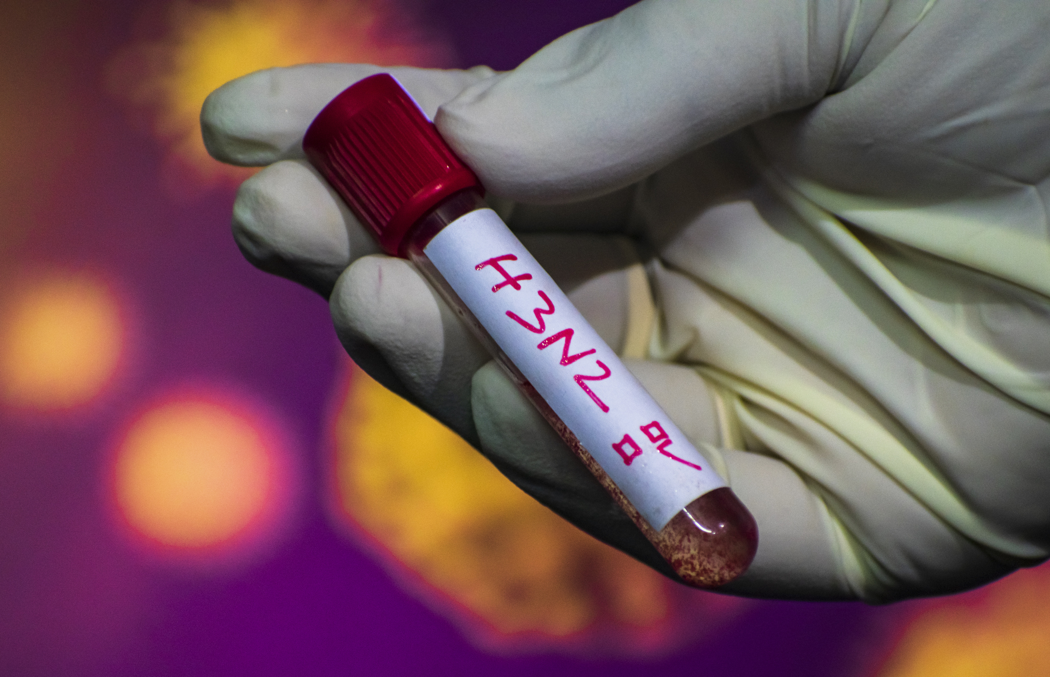 Cuáles son las diferencias entre la influenza A(H3N2) y el Covid-19