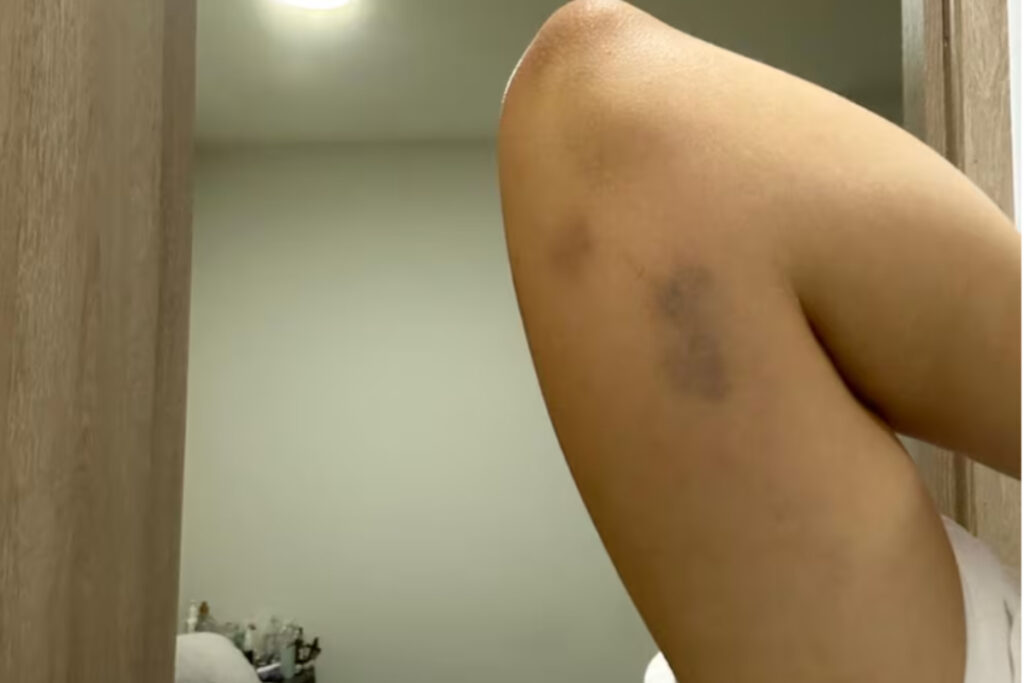 Pruebas de la supuesta agresión. Foto: Semana.