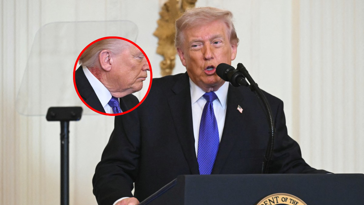 Donald Trump y la mancha roja en el cuello: explicación oficial de Casa Blanca