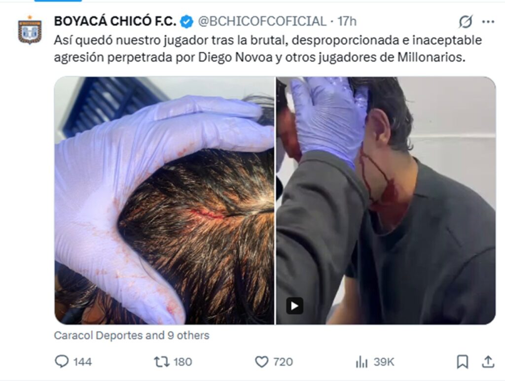 X de Boyacá Chicó