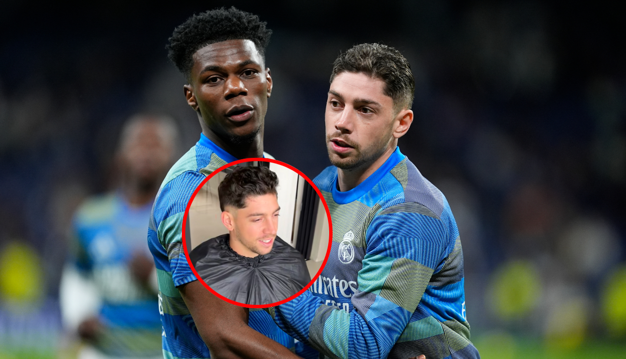 Aparece cicatriz de Federico Valverde tras pelea con Tchouaméni en Real Madrid