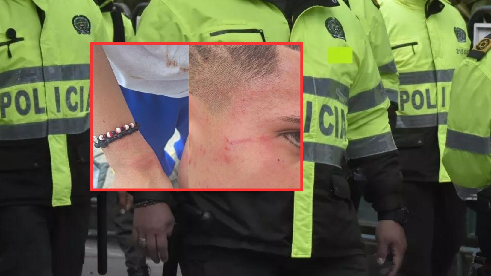 Denuncian presunto abuso policial en Bogotá: menor de edad habría sido agredido