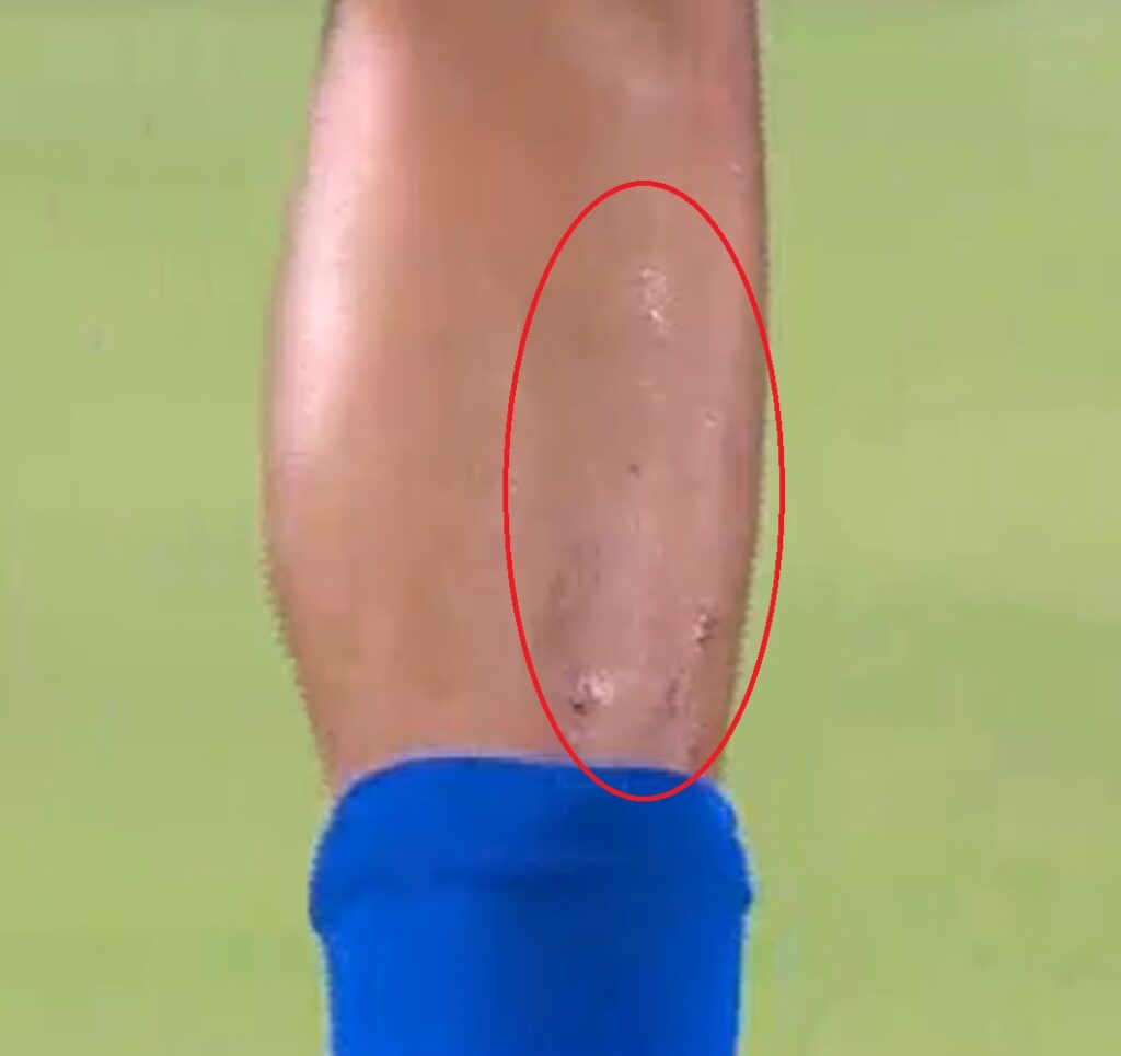 Captura de pantalla por la patada a Sebastián Valencia 