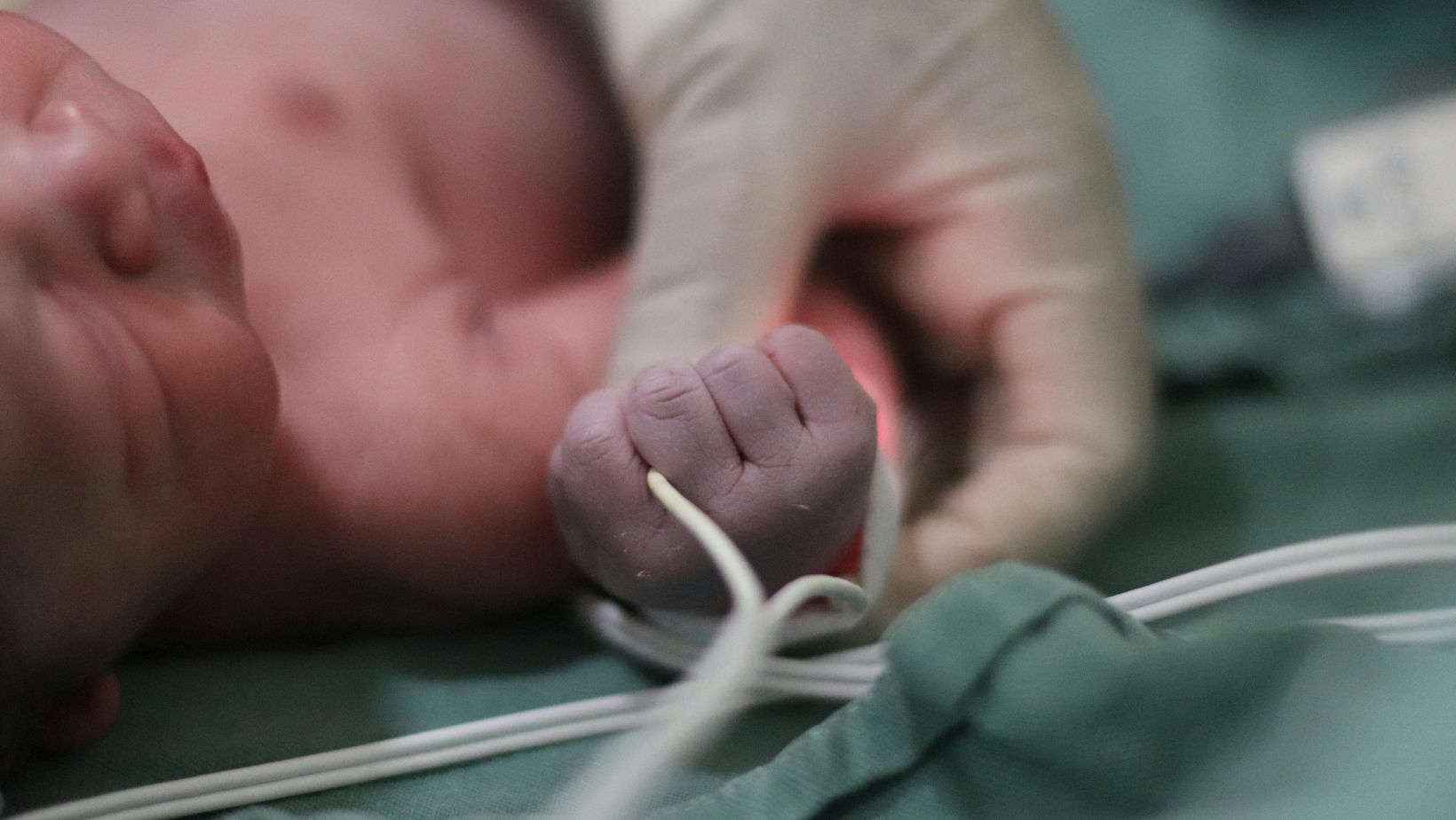 Bebé de 5 meses casi muere por golpe en la cabeza: su padre fue capturado