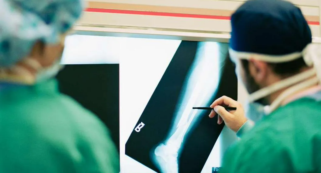 Foto de médico viendo radiografía, en nota de a hombre con pierna amputada le rompen la otra en hospital en Perú: cómo sucedió
