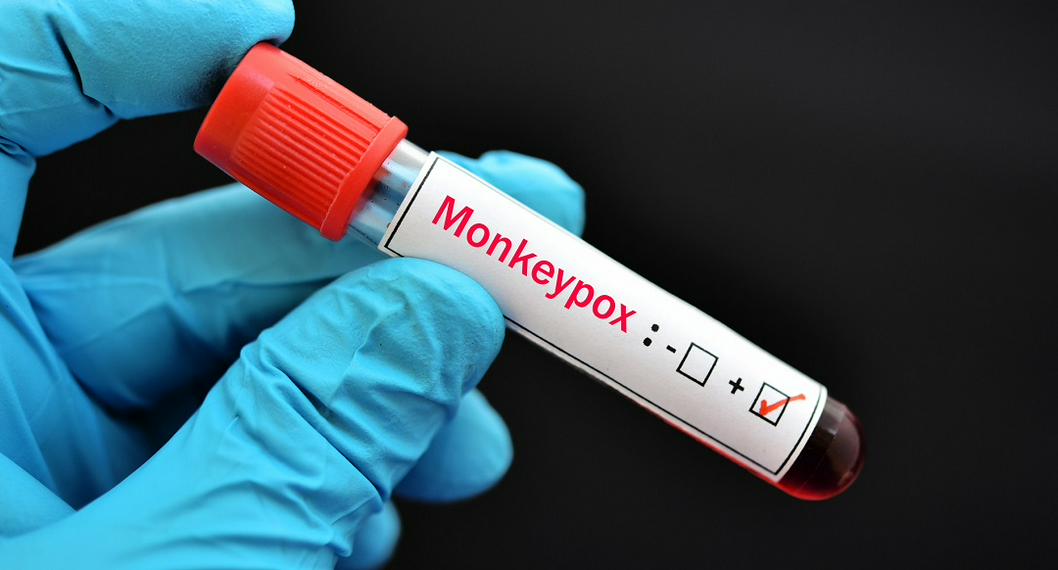 Esta es una de las vacunas para combatir a la viruela del mono, enfermedad de la que no se volvieron reportar casos en Bogotá.