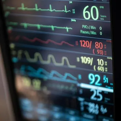 Signos vitales de un paciente en cuidados intensivos, como lo está la reforma a la salud tras quedar sin apoyos clave.