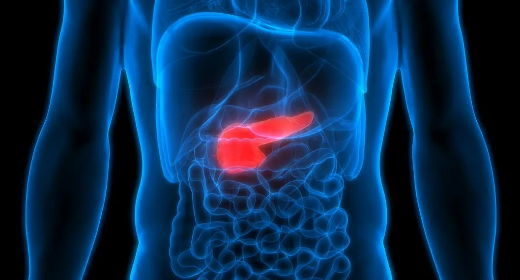 Una investigación de Estados Unidos reveló cuál es la proteína que causa el cáncer de páncreas y cómo es su funcionamiento en el cuerpo; detalles.