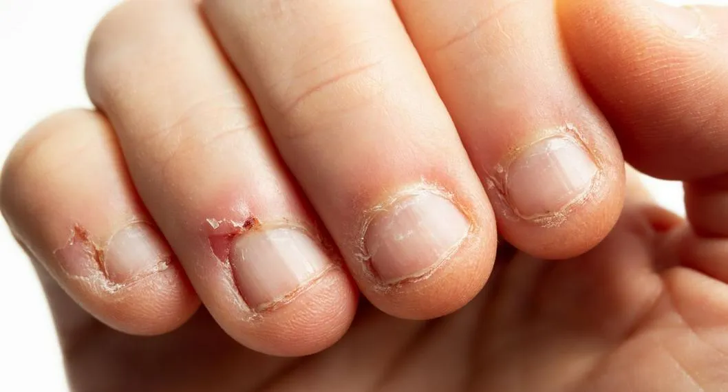 El uso excesivo de limas, esmaltes y productos químicos afectan el crecimiento de las uñas
