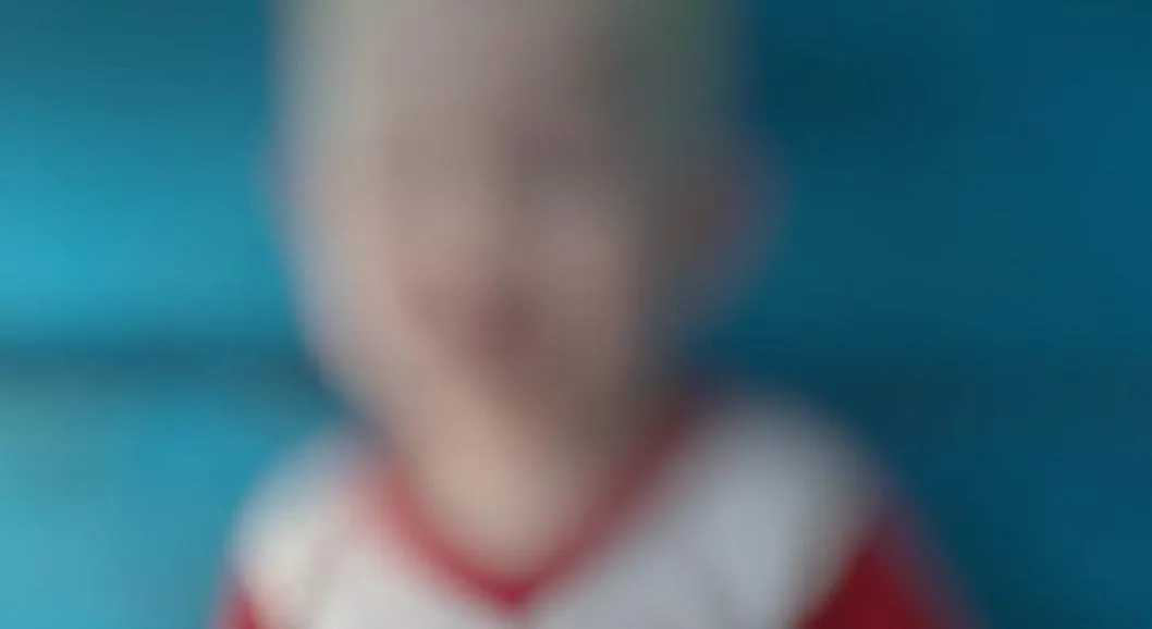 Niño albino de Valledupar necesita medicamentos de alto costo