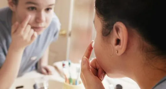 ¿Cuál es el mejor tratamiento para el acné?