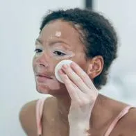 Usar limón en la cara tiene efectos adversos que pueden ser dañinos para la piel; puede causar irritación, quemaduras o vitiligo por contacto