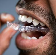 Los alineadores invisibles sirven para alinear los dientes, pero la ortodoncista Gloria Rivera dice que no ayuda a tener una mordida funcional
