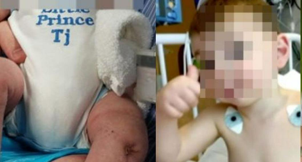 Niño perdió las piernas por agresión de su papá cuando era recién nacido