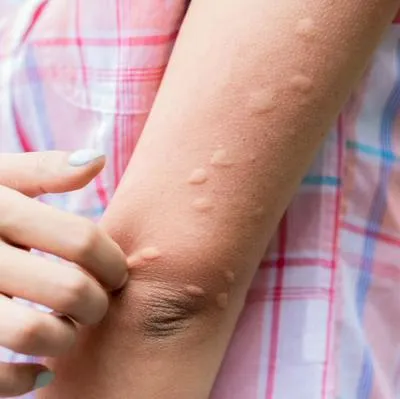 Los mosquitos pican con mayor frecuencia a la personas que tienen sangre tipo O. Además, se sienten atraídos por los olores corporales y colores vivos