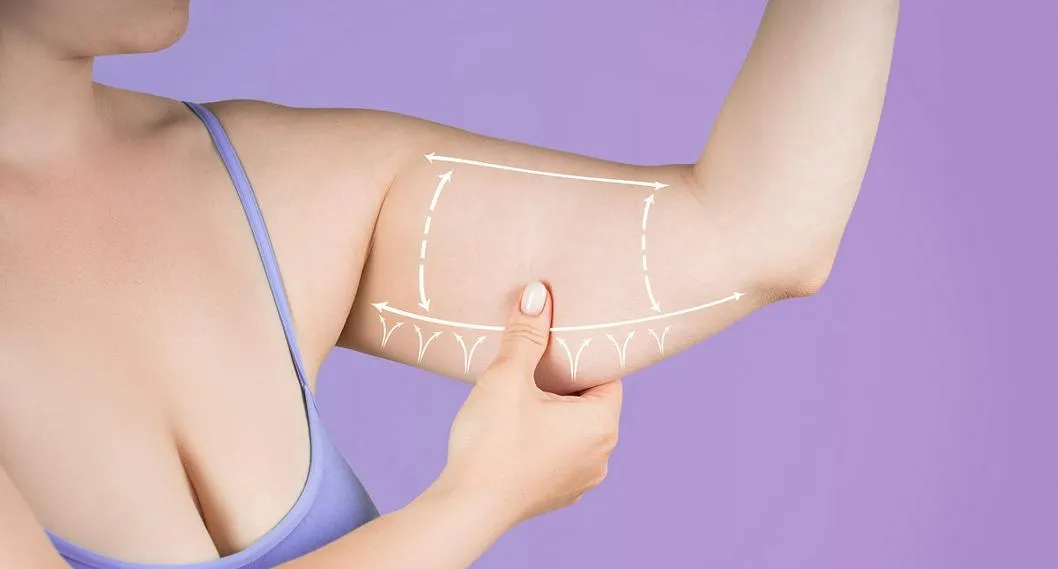 Brazo con grasa. En relación a cómo bajarlos.