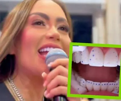 'Epa Colombia' reveló diamantes en sus dientes | Por qué 'Epa Colombia' lleva diamantes en sus dientes | Cuántos diamantes tiene 'Epa Colombia' en la boca