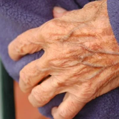 Un hombre de 88 años en Valledupar perdió la vida luego de subirse a un árbol, perder el equilibrio y caer de frente. Se golpeó la cabeza.