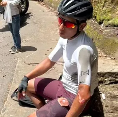 Nairo Quintana, que sufrió fuerte caída mientras entrenaba: heridas en brazo y pierna