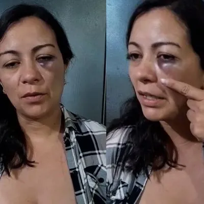 Profesora de colegio en Bogotá fue agredida por estudiante que le propinó un golpe en la cara. La docente denunció que su ojo le quedó morado. 