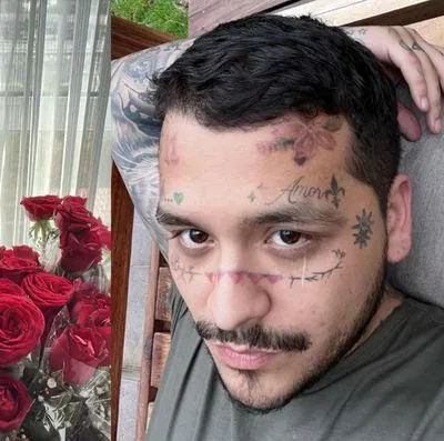 Christian Nodal borró algunos de sus tatuajes de su rostro, argumentando que quiere que su hija, que tendrá con la también cantante Cazzu, le conozca la cara. El tratamiento le puede costar hasta 4.000 dólares.