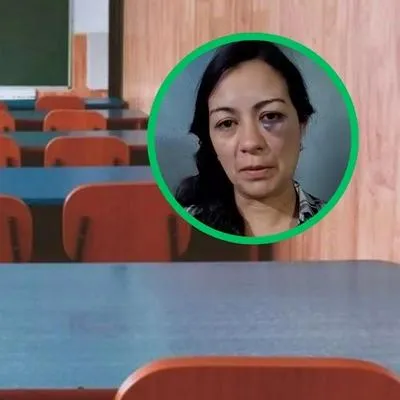 Así quedó la profesora agredida por una estudiante en un colegio de Bogotá. La alumna está incapacitada