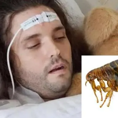 Hombre en Texas, Estados Unidos, perdió sus brazos por la picadura de una pulga