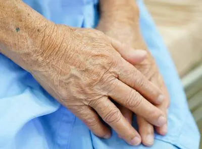 Manos de adulto mayor. En relación con abuso y golpes en hogar geriátrico.