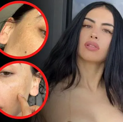 Jessica Cediel mostró su cara sin maquillaje para evidenciar su problema de piel