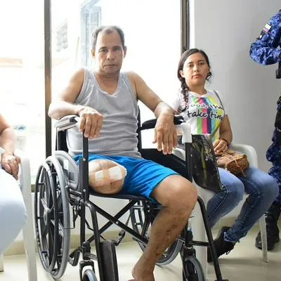 Elías Pacheco, taxista que perdió su pierna en accidente.