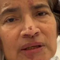 Colombiana hospitalizada en Portugal sufrirá amputaciones: envió fuerte mensaje