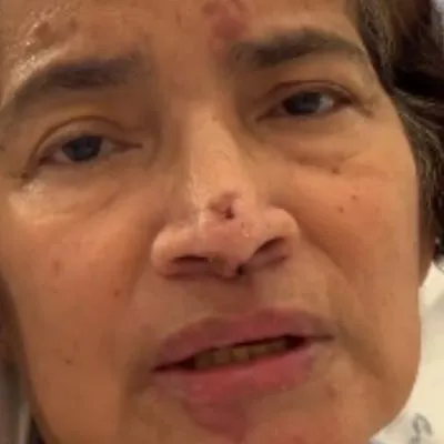 Colombiana hospitalizada en Portugal sufrirá amputaciones: envió fuerte mensaje