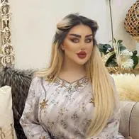 Dalia Naeem, la Mujer se hizo 40 cirugías para parecerse a Barbie. 