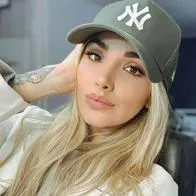 Foto de Melina Ramírez, en nota de que la presentadora de Yo me llamo (Caracol) mostró paso personal que le aguó el ojo
