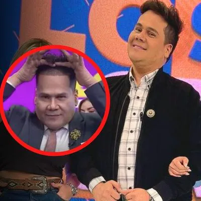 Ariel Osorio, presentador de Lo sé todo, Colombia, que contó cómo se hizo trasplante de pelo.