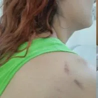 Ibagué: mujer cayó de un balcón luego de recibir ataques de su expareja