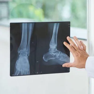 Cerca del 45% de los humanos no tendría este hueso, 