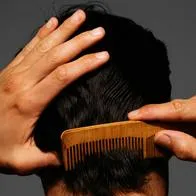 La caída del cabello, se produce por diversas razones la falta de vitamina podría ser una de las más importantes.