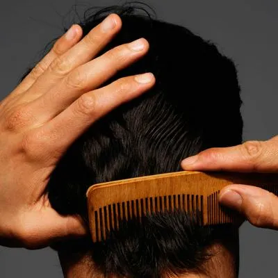 La caída del cabello, se produce por diversas razones la falta de vitamina podría ser una de las más importantes.