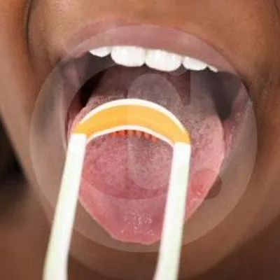 Raspado de lengua es promovido en India y sería clave en la salud bucal