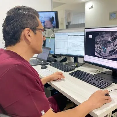 Método oncológico que hacen en Antioquia para tratar el cáncer de cuello uterino da resultados positivos