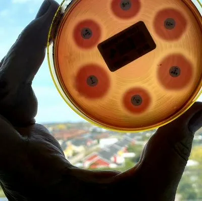 Imagen ilustrativa a propósito de la infección con bacterias come carne en el Caribe.