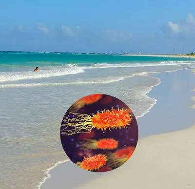 Estados Unidos alertó que la bacteria se ha dispersado por Golfo de México y el Caribe.