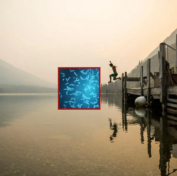 Un menor vivió lamentable historia por culpa de una bacteria que, al parecer, estaba en el agua.